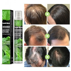 South Moon Hair Growth Serums, Hair Anti-Drop Liquid Hairline Thick Hair Herbal Essential Oil