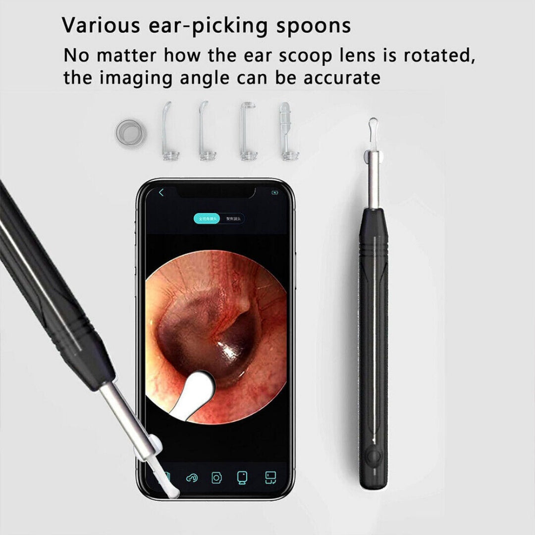 Smart Visual Earpick Ear Wax Removal Cleaner WiFi Ear Stick Endoscope Camera AU-black