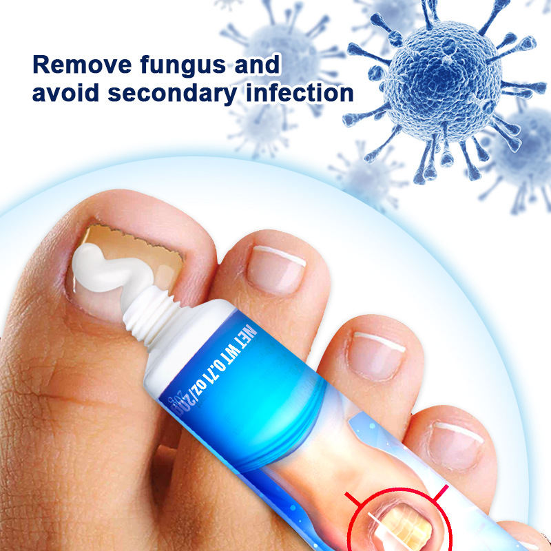 20g Onychomycosis Care Emulsifiable Paste