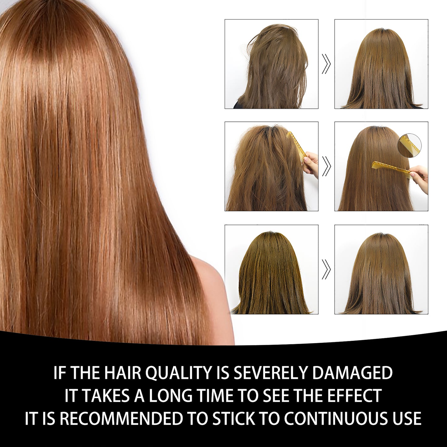 West&Month Hair Growth Essential Oil, Dense Hair Growth Repair Dry Hair And Moisture Hair Essence