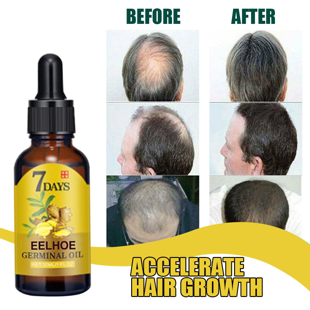 EELHOE Ginger Hair Care Solution For Hair Nourishing And Moisturizing Hair Care For Hair Stabilizing And Preventing Hair Loss