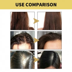 OUHOE Ginger Dense Hair Shampoo, Moisturizes Reduces Itchiness, Strengthens Dense And Fluffy Hair Care Shampoo