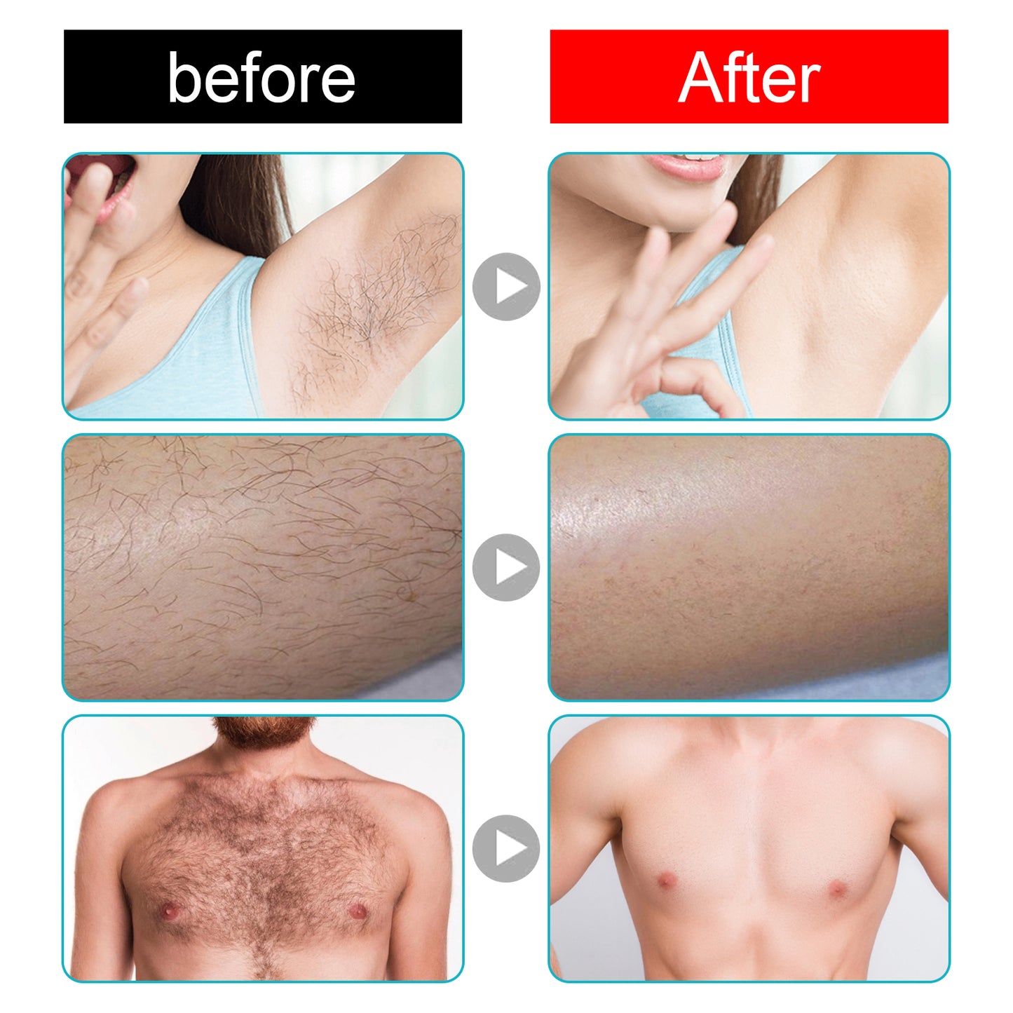 Jaysuing Hair Removal Cream, Full Body Underarm, Hand And Foot Hair Quick Hair Removal Cream Gentle And Non-irritating
