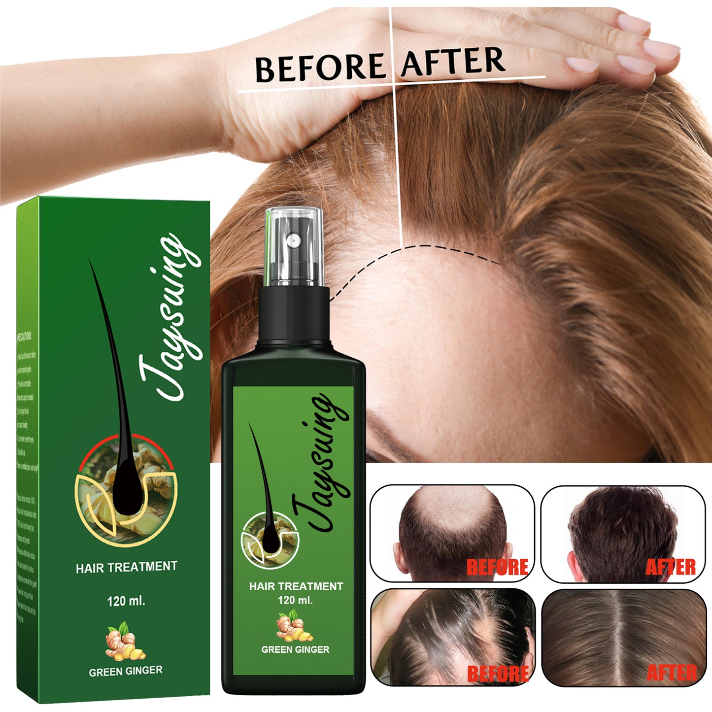 Jaysuing Hair Treatment, Strengthens Hair, Nourishes Root Growth And Thickens Scalp Massage Nutrient Solution