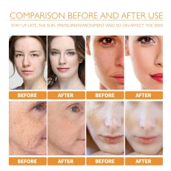West&Month Turmeric Facial  , Moisturizing Lightening Spots, Acne Marks, Brightening Skin Essence