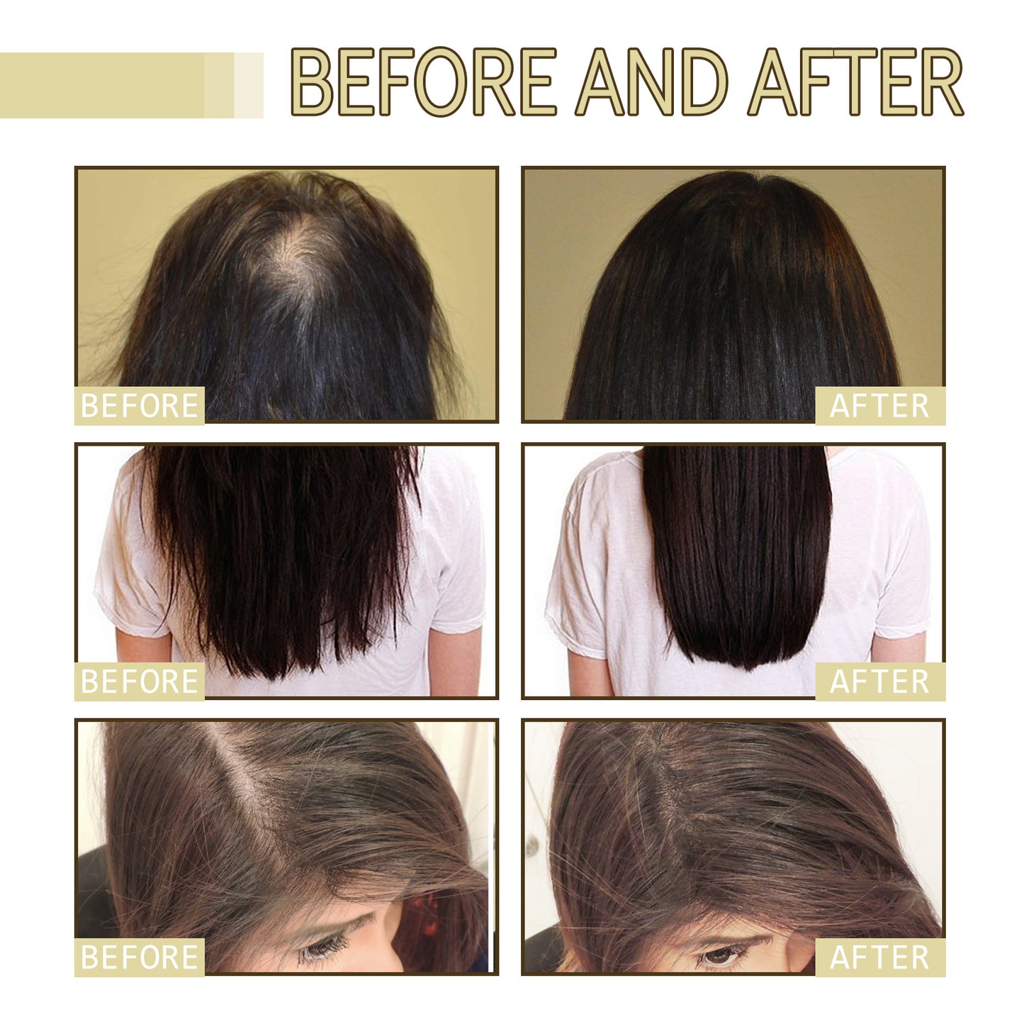 EELHOE Rosemary Dense Hair Essential Oil Repair Hair Damage, Prevent Hair Loss, Smooth Hair, Nourish Hair Care Oil