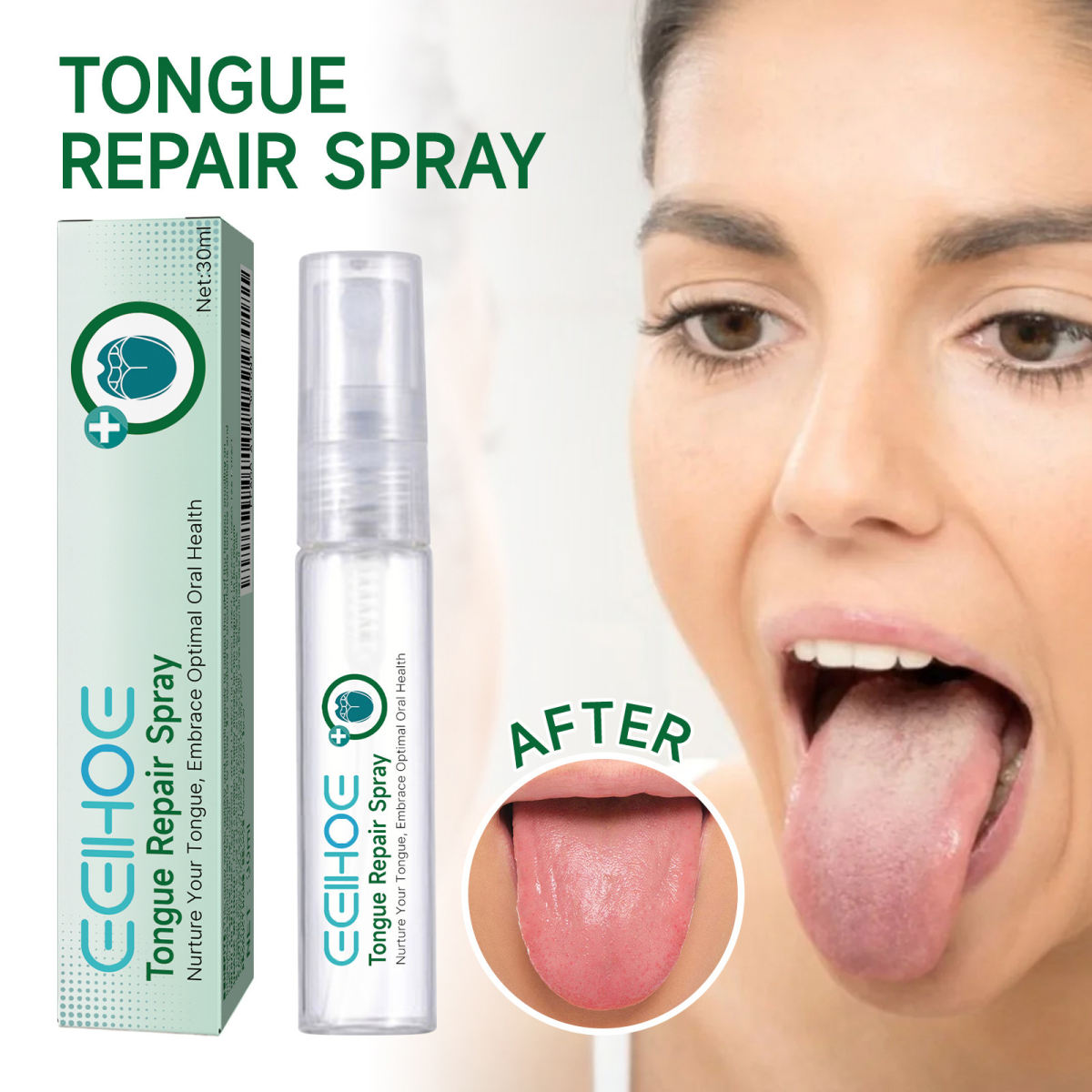 Curing Tongue Coating Whitening Relieving Tongue Cracking Swelling Oral Care Spray
