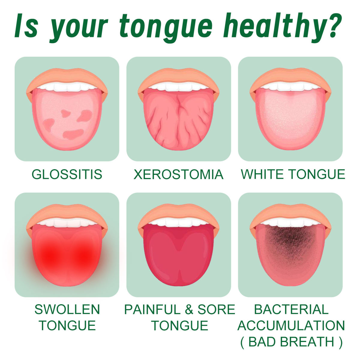 Curing Tongue Coating Whitening Relieving Tongue Cracking Swelling Oral Care Spray