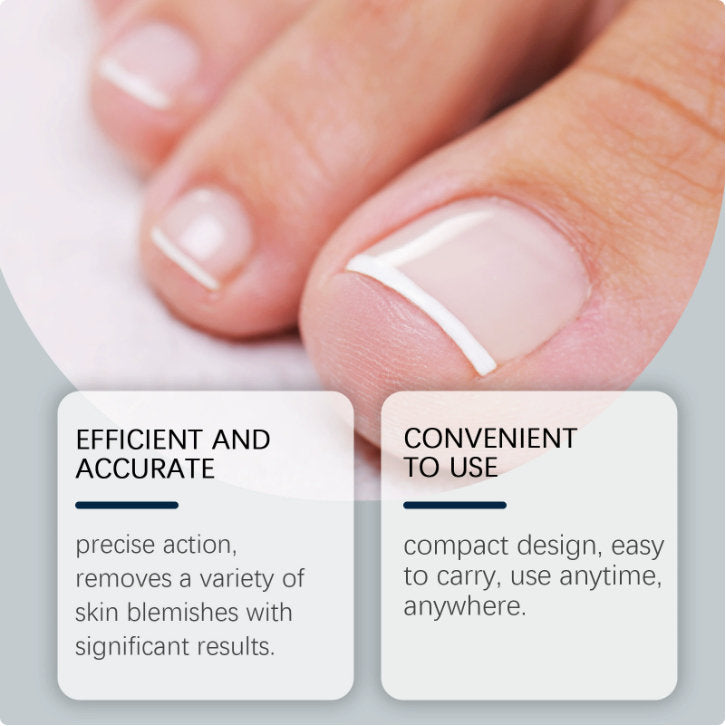 Light Care Nail Renew Pro Device