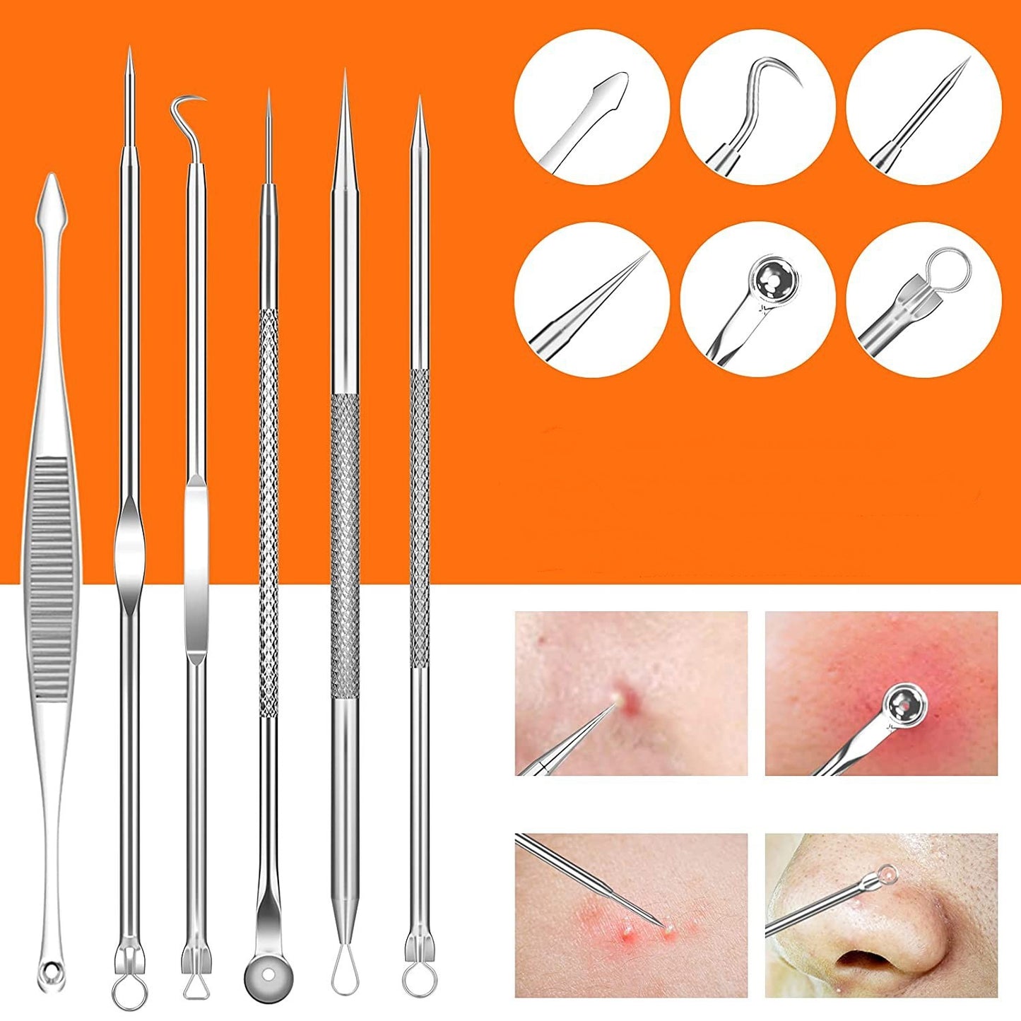 Stainless Steel Portable Blackhead Removing Acne Beauty Tool