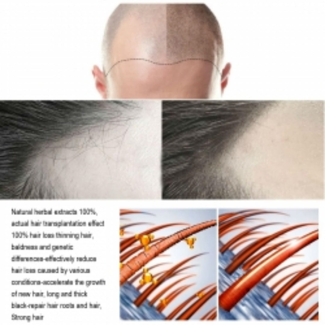 Jaysuing Hair Conditioner, Strengthens Hair, Nourishes Root Growth And Thickens Scalp Massage Nutrient Solution