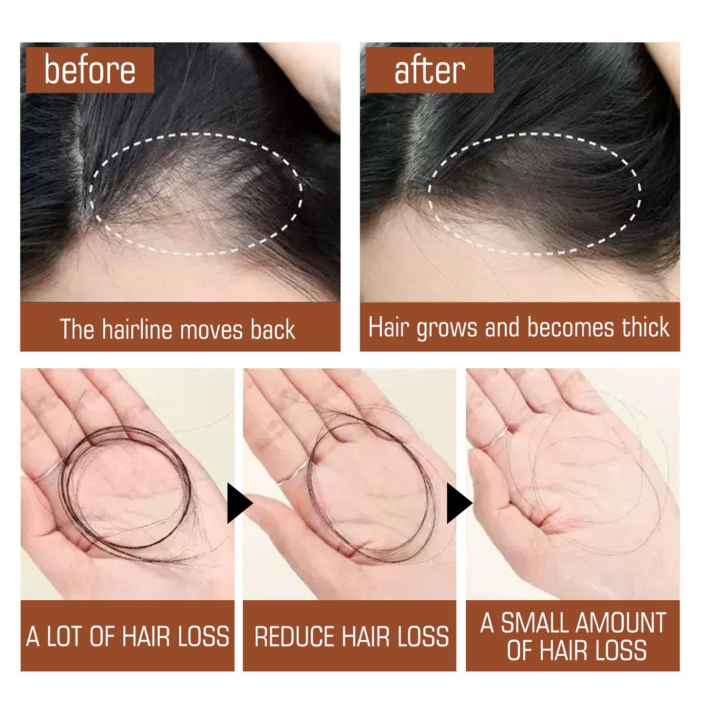 EELHOE Batana Oil Conditioner Moisturizes, Repairs, Strengthens Hair Roots, Prevents Supple, Dense Hair, And Solidifies And Fluffy Hair
