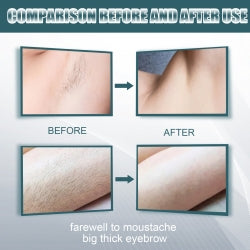 EELHOE Men's Hair Removal Cream, Facial Armpit Leg Chest Hair Clean Not Damaging Skin Hair Removal Cream