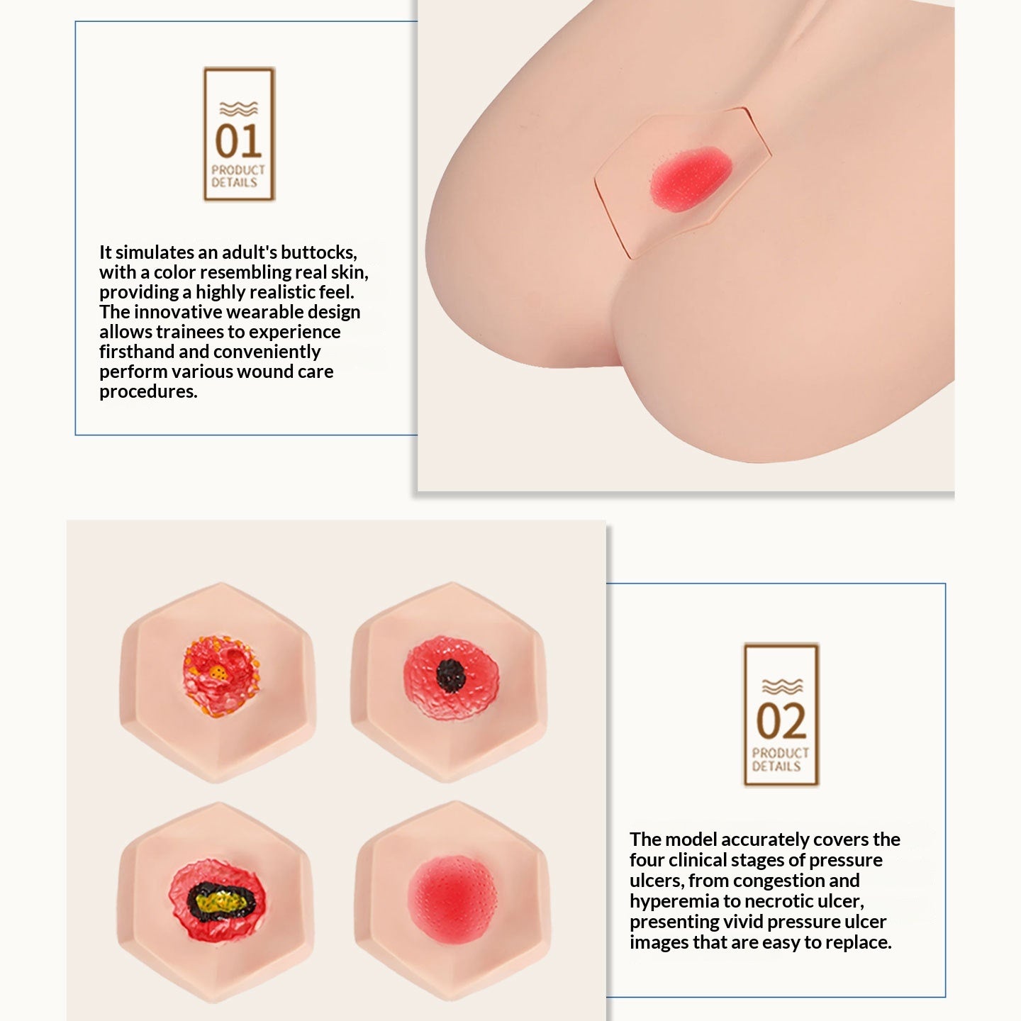 Stage Pressure Ulcer Care Model
