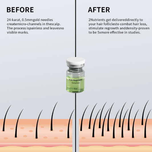 Hair Microneedle Serum For Thickening The Scalp