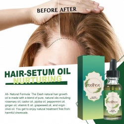 EELHOE Hair-Serum Oil, Nourish The Scalp Hair Loss Prevention Dense Moist Strong Hair, Protect Hair Oil