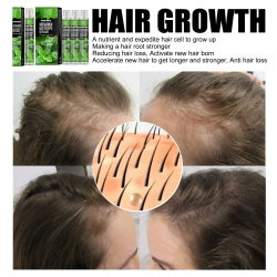 South Moon Hair Growth Serums, Hair Anti-Drop Liquid Hairline Thick Hair Herbal Essential Oil