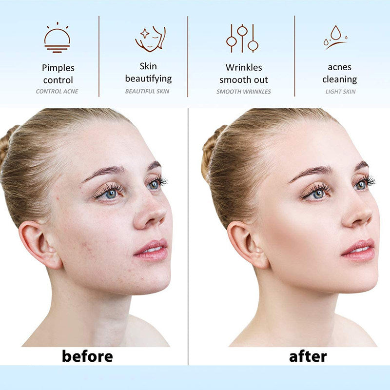 High-Frequency Facial Beauty Device Skin Care Electrode Stick