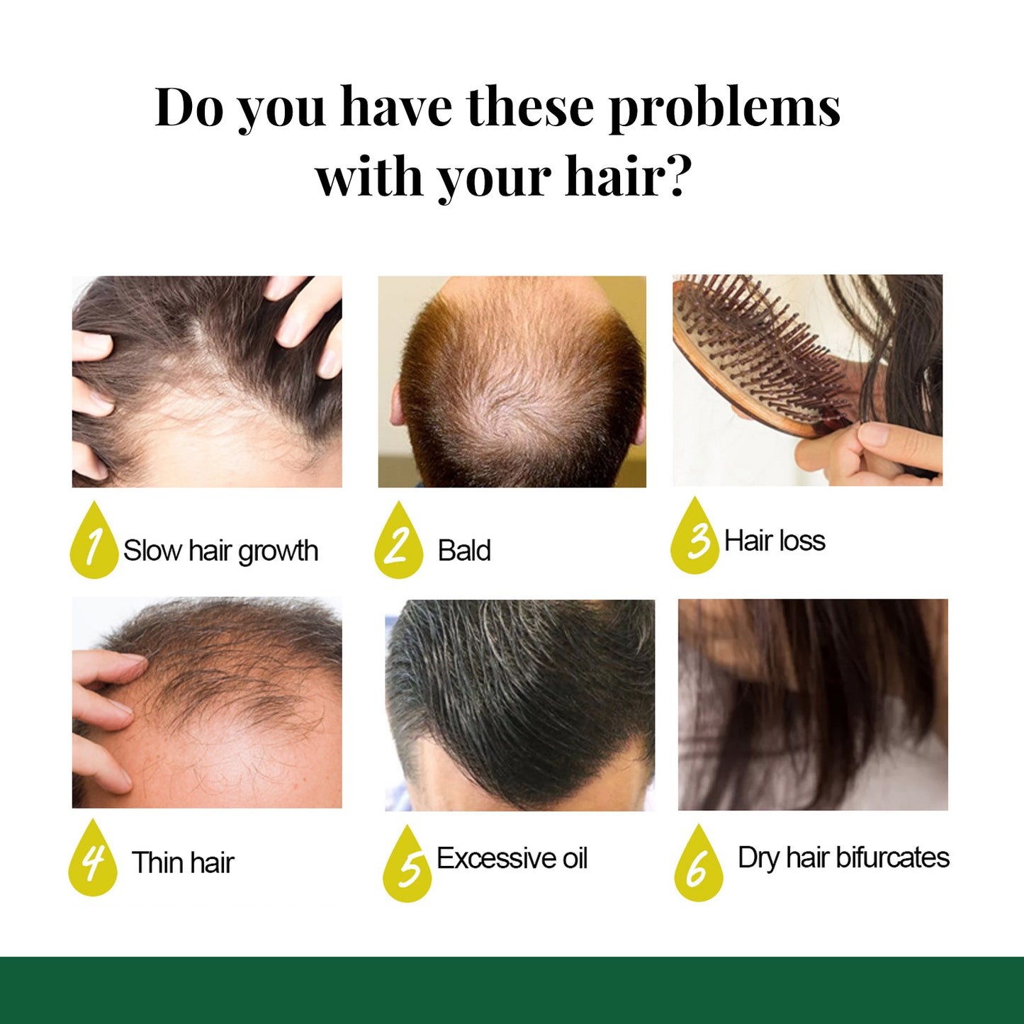 EELEelhoe Ginger Hair Spray, Strengthens Hair, Massages Scalp And Restores Hair