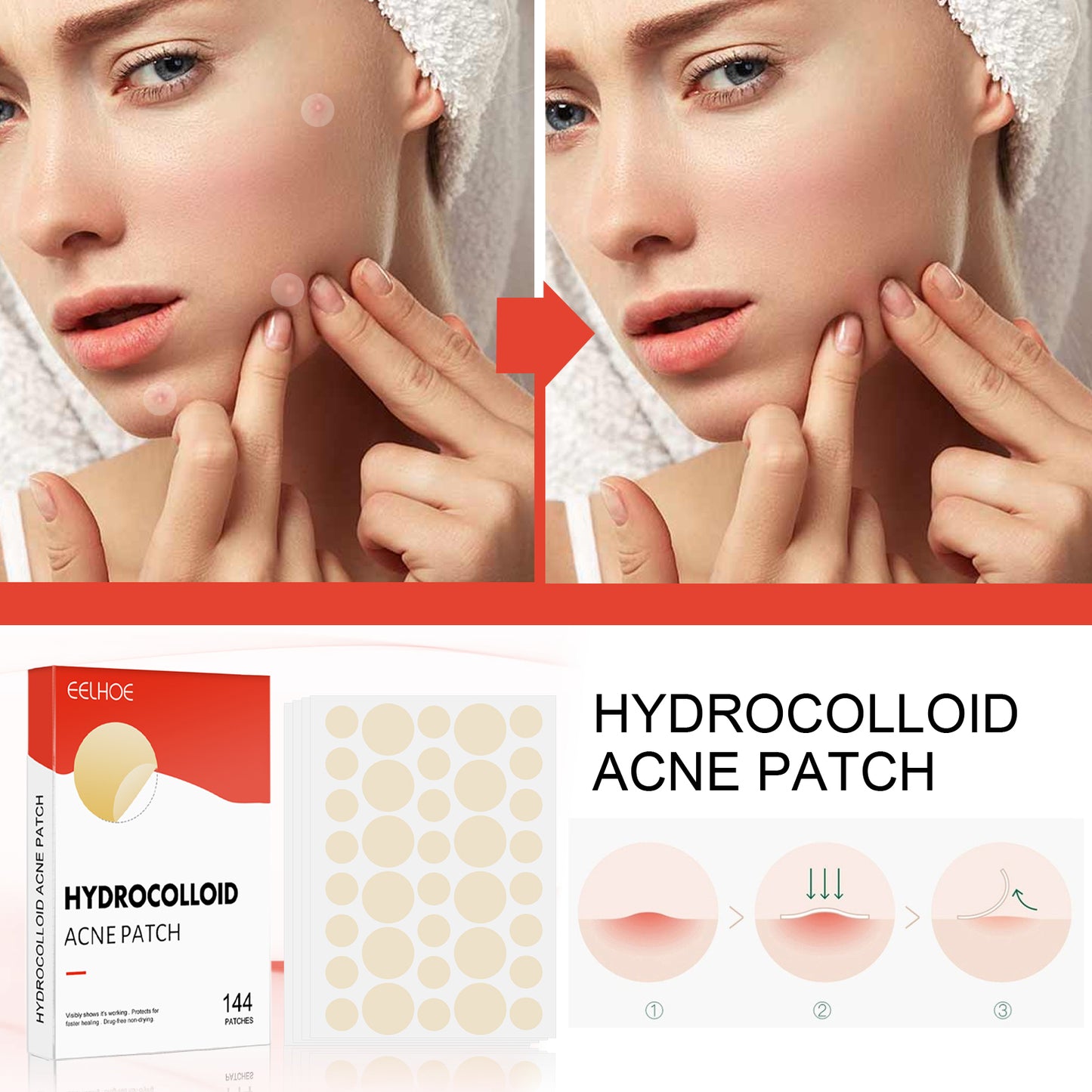 EELHOE Hydrocolloid Acne Patch, Facial Invisible Makeup Clean Acne Waterproof Breathable Acne Muscle Repair Patch