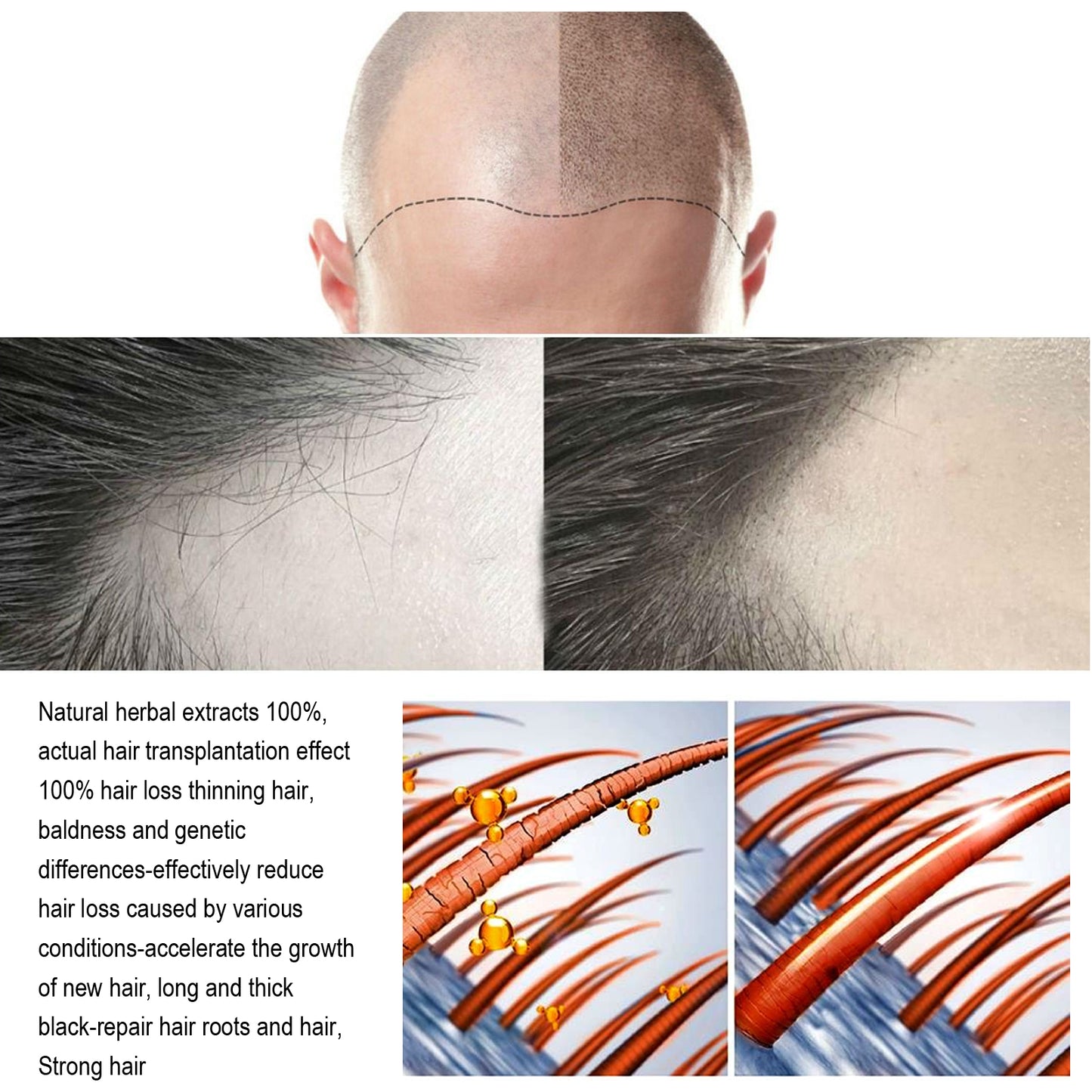 Jaysuing Hair Treatment, Strengthens Hair, Nourishes Root Growth And Thickens Scalp Massage Nutrient Solution