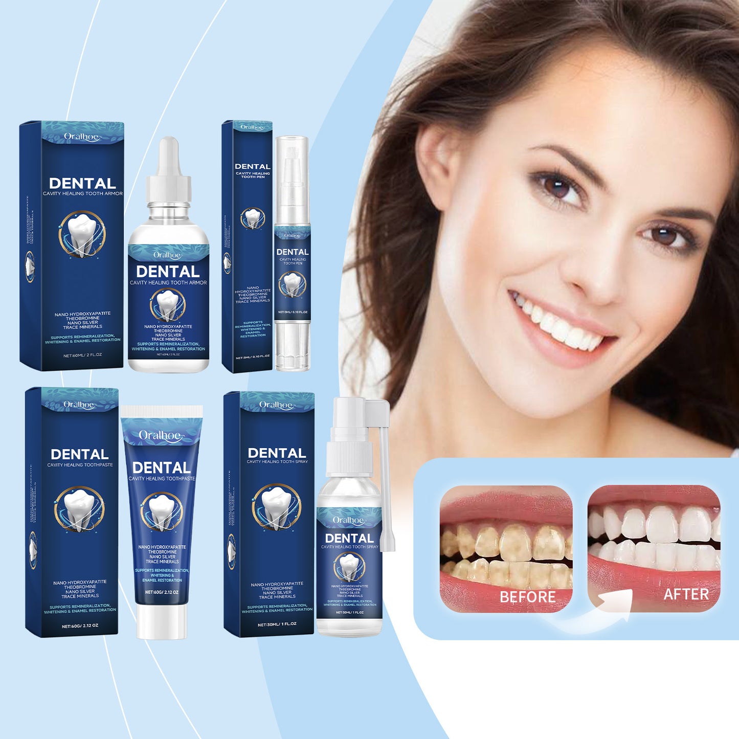 ORALHOE Dental Care Gently Cleans Stains And Tartar For A Fresh