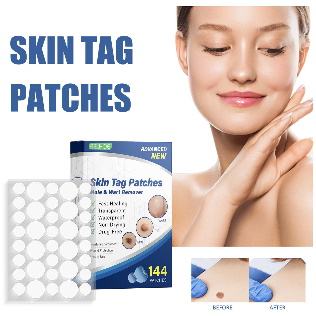 Wart Close To Skin Mole Black Mole Cleaning Care Skin Label Remover Patch