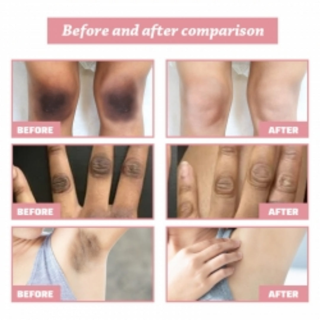 West&Month Body Brightening Cream, Repair Joint Black Fade Black Acanthosis Skin Moisturizing Whitening Skin Body Cream