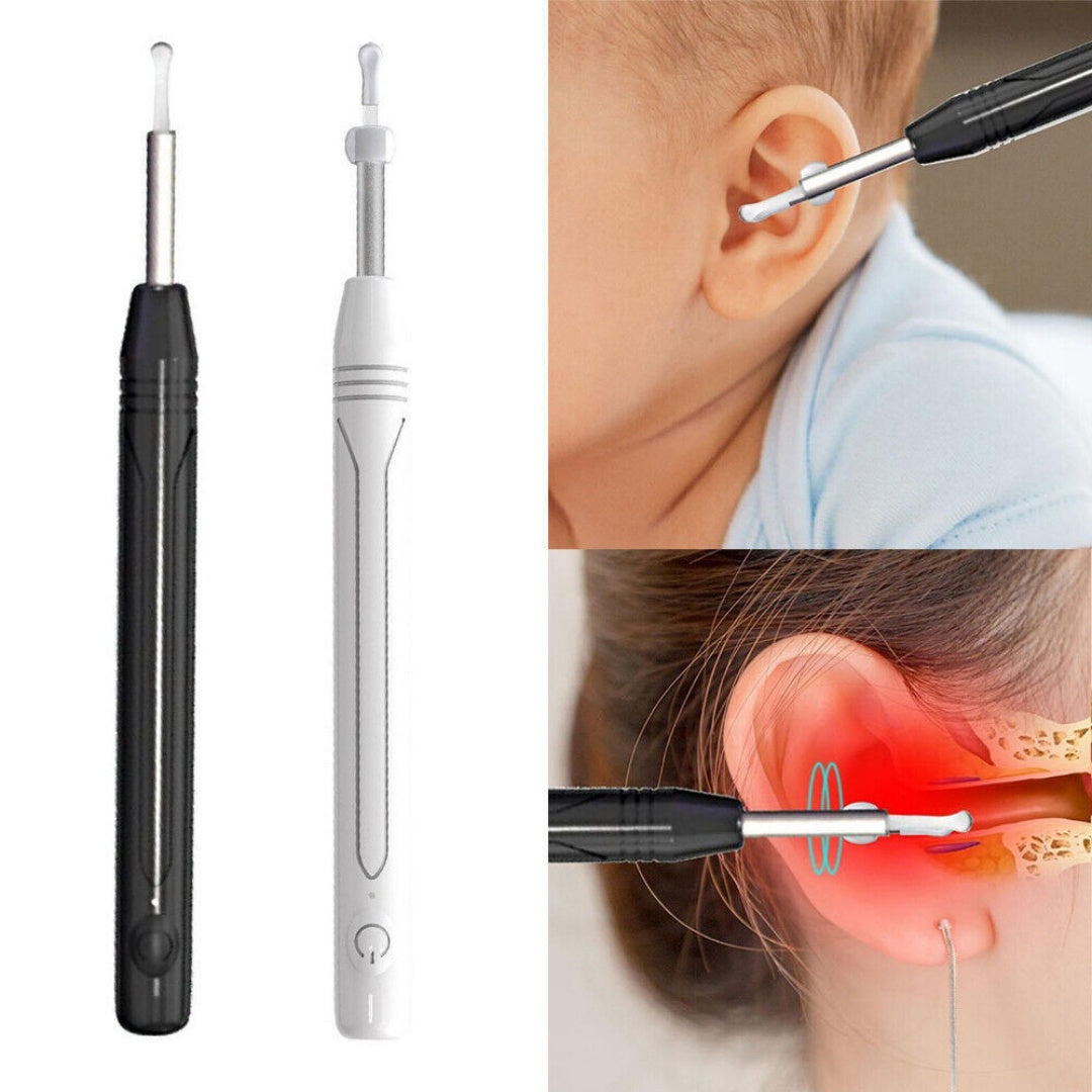 Smart Visual Earpick Ear Wax Removal Cleaner WiFi Ear Stick Endoscope Camera AU-black